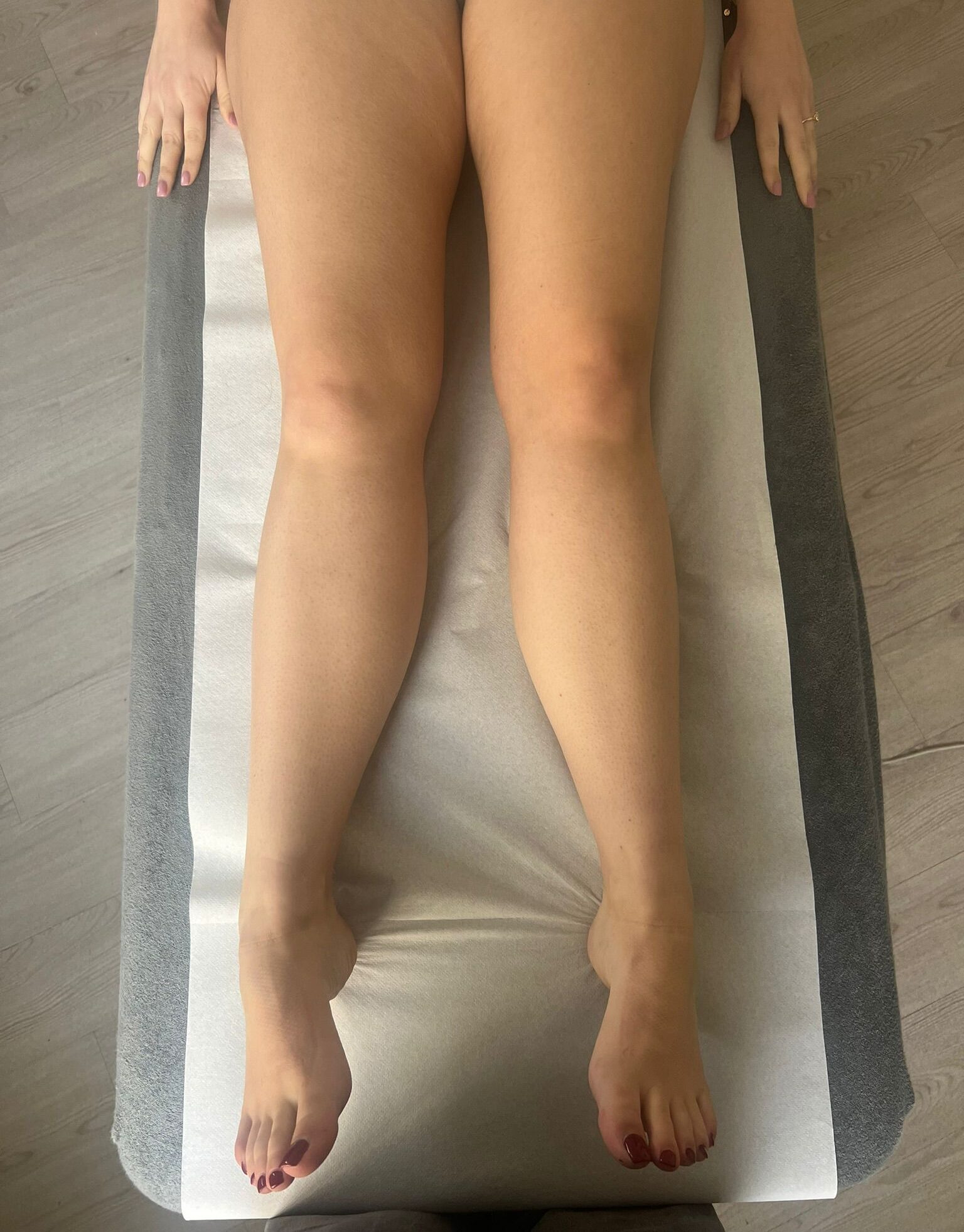 Drainage Renata França - Patiente avant drainage